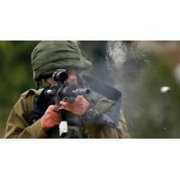25 إصابة بالرصاص و20 بالاختناق خلال انسحاب قوات الاحتلال من قرية روجيب بنابلس