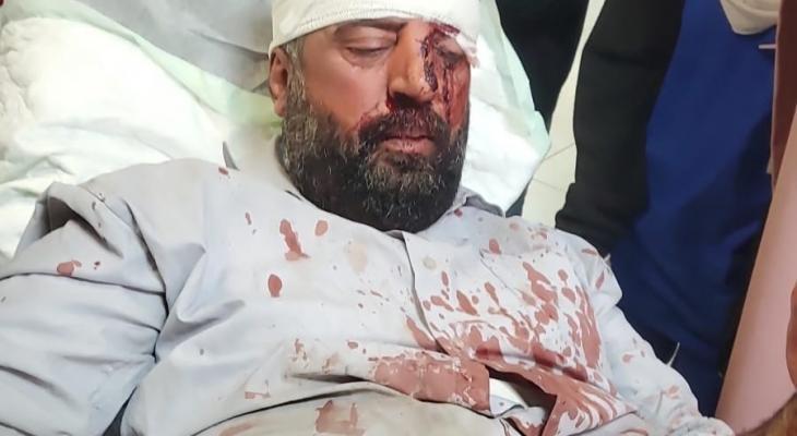 إصابتان في اعتداء للمستوطنين شمال نابلس