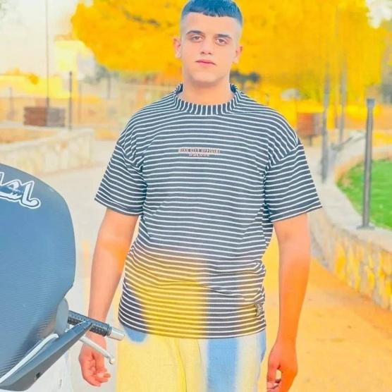 استشهاد طفل متأثراً بإصابته برصاص الاحتلال في طوباس