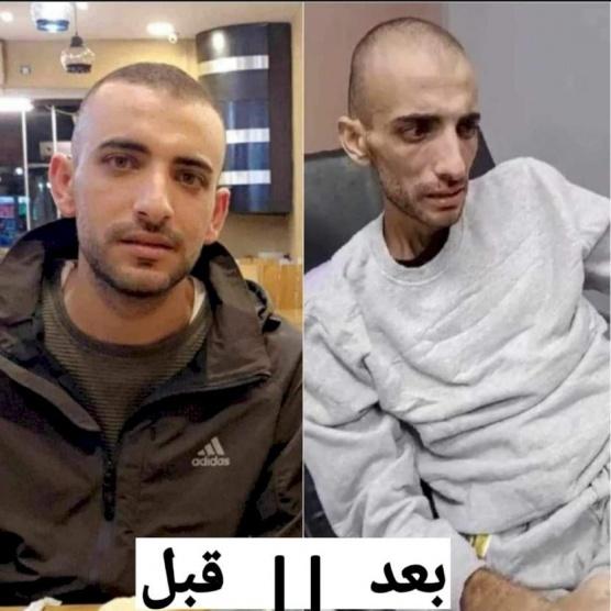سجون الاحتلال تحول جسد أسير إلى