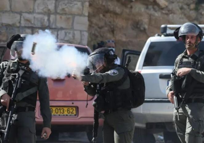 إصابتان برصاص الاحتلال شمال القدس