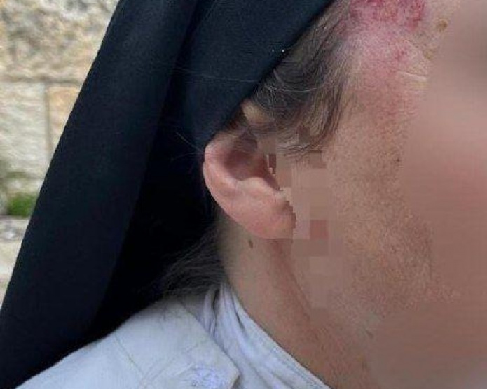 إصابة راهبة باعتداء مستعمر في القدس المحتلة